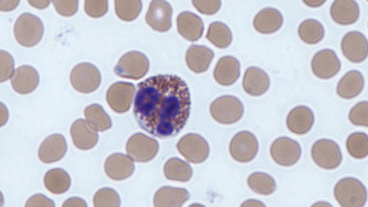 An eosinophil, a type of white blood cell. A new study shows these cells can be “summoned” to fight cancer. (Dr. Graham Beards/Wikimedia Commons)